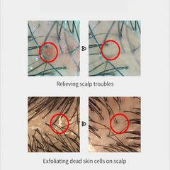 SCALP MASSAGER  FOR HAIR GROWTH