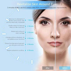 CareJoy™ Eye Massage Pen