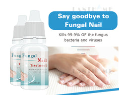 Fungal Nail Treatment Essence Nail And Foot Fungus Removal Feet Care Gel
