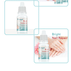 Fungal Nail Treatment Essence Nail And Foot Fungus Removal Feet Care Gel