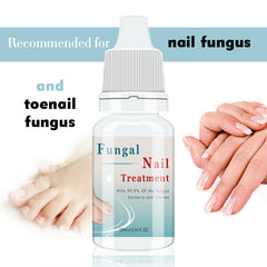 Fungal Nail Treatment Essence Nail And Foot Fungus Removal Feet Care Gel