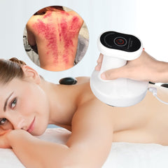 Electric Cupping Massage