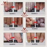 Fungal Nail Treatment