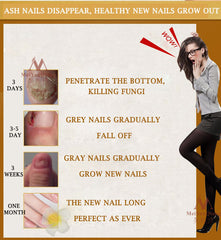 Fungal Nail Treatment