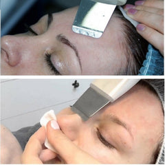 Ultrasonic DEEP CLEANING PORES WITH SPATULA