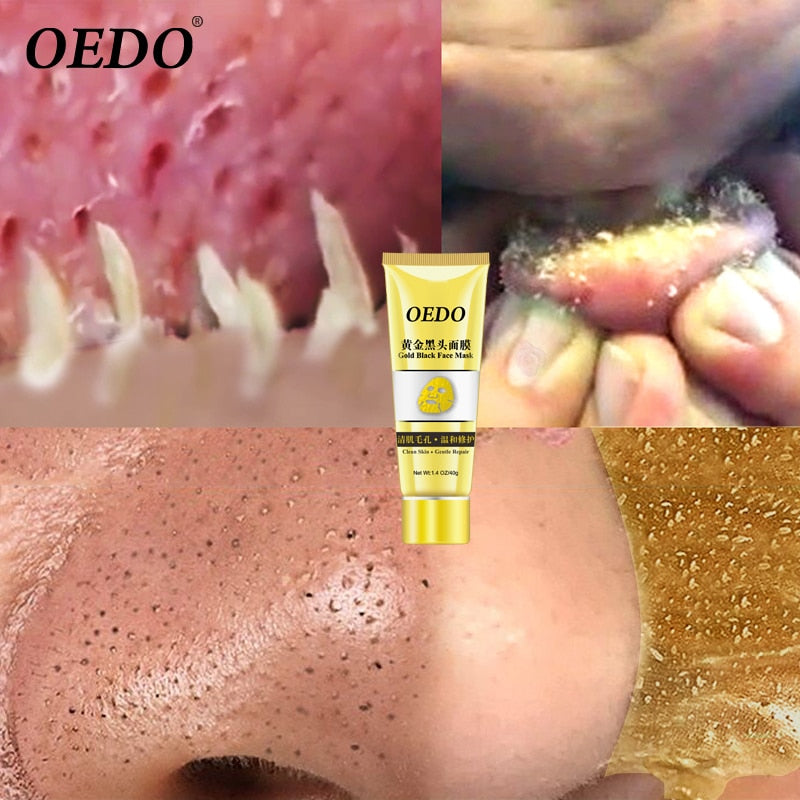 OEDO Gold Remove Blackhead Mask Shrink Pore Improve Rough Skin Acne Shills Blackhead Remover Mask Facial Moisturizing Cream
