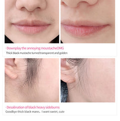 Upper Lip Hair Remove Cream