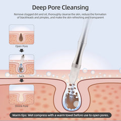 Professional Microdermabrasion Machines For Home Use