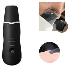 Facial Skin Ultrasonic Exfoliator