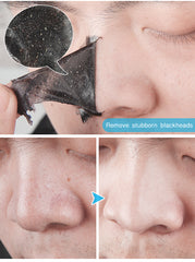 Bamboo Charcoal Skin Care System