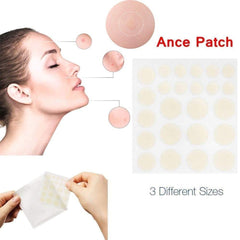 Hydrocolloid Acne Healing Pimple Patch 24pcs