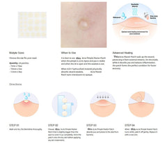 Hydrocolloid Acne Healing Pimple Patch 24pcs